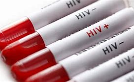 Hiv 1/2 Là Gì